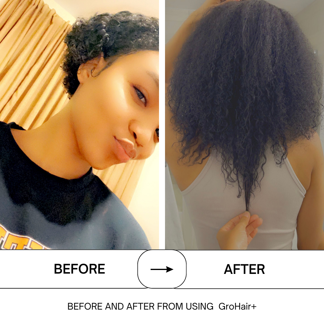 GroHair+ The Hair Food