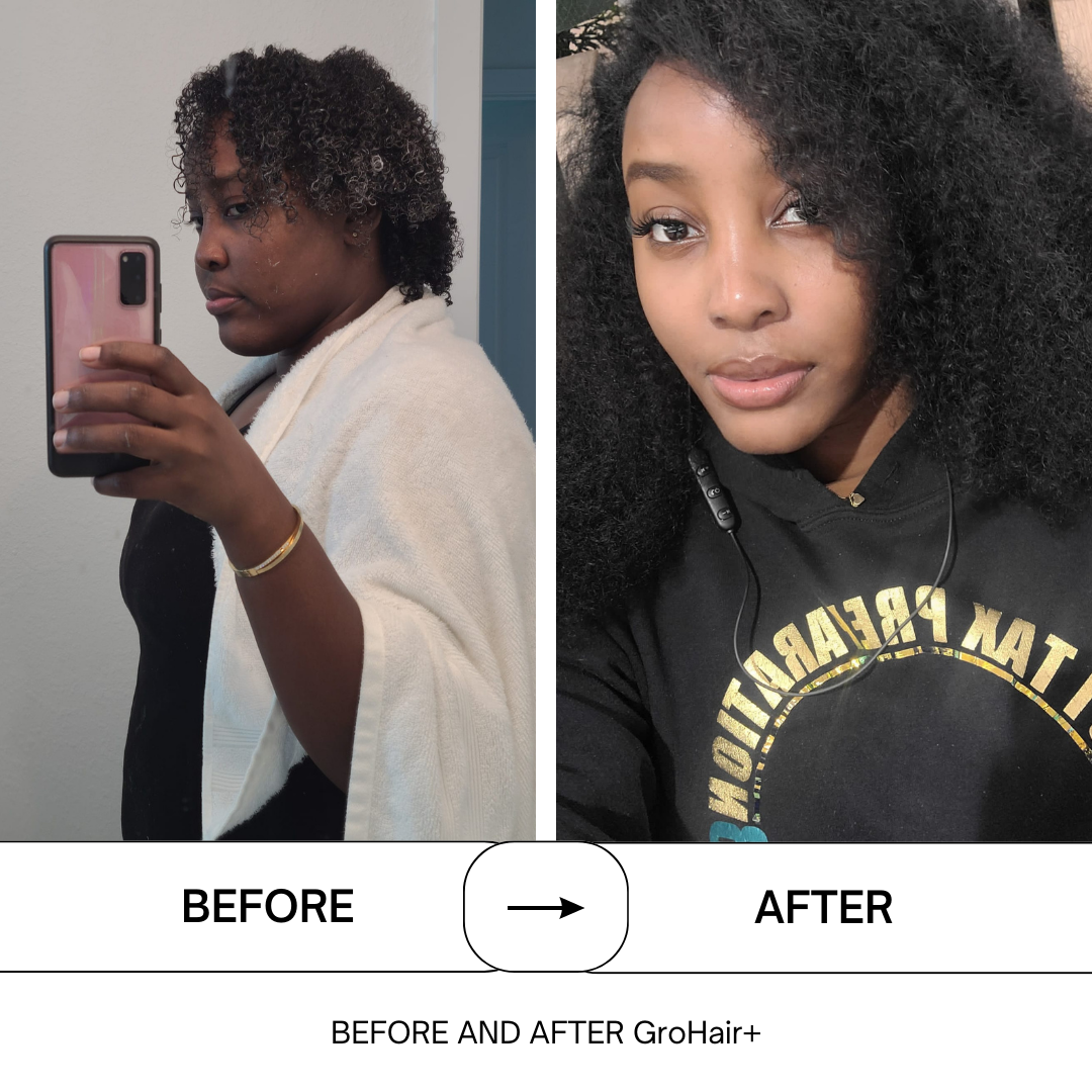GroHair+ The Hair Food